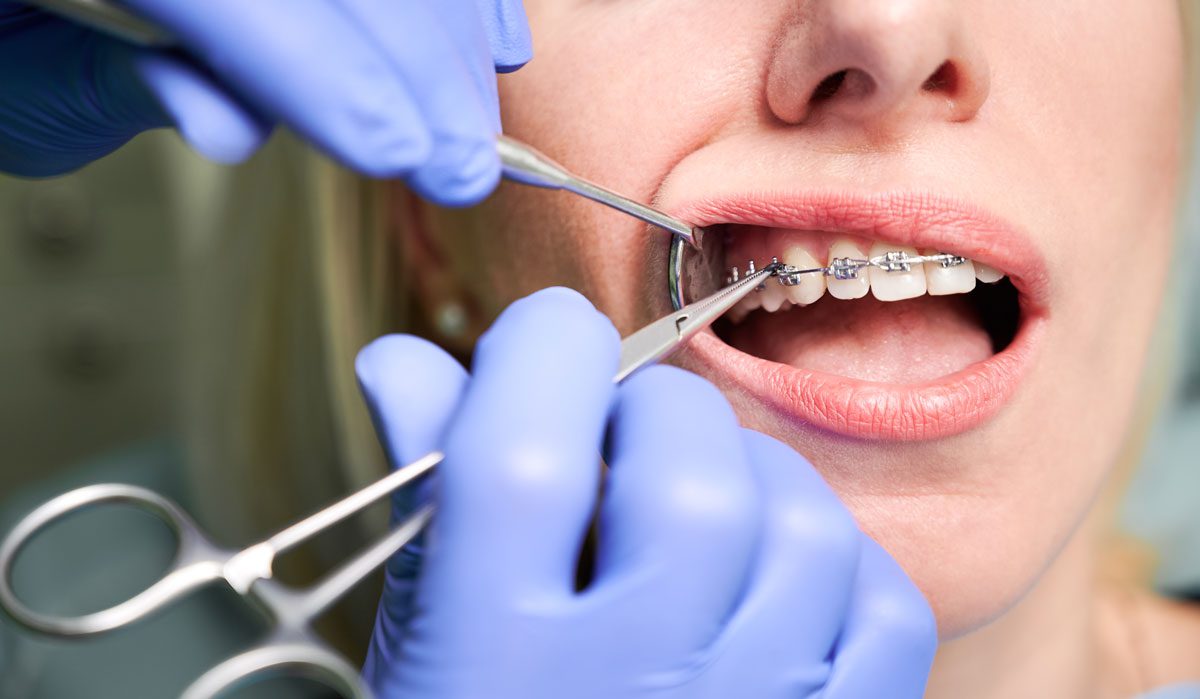 Is Orthodontics Cosmetic Dentistry? Golden State Dentists